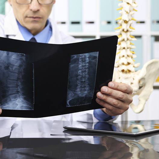 How To Know if you have a Disc Herniation Photo